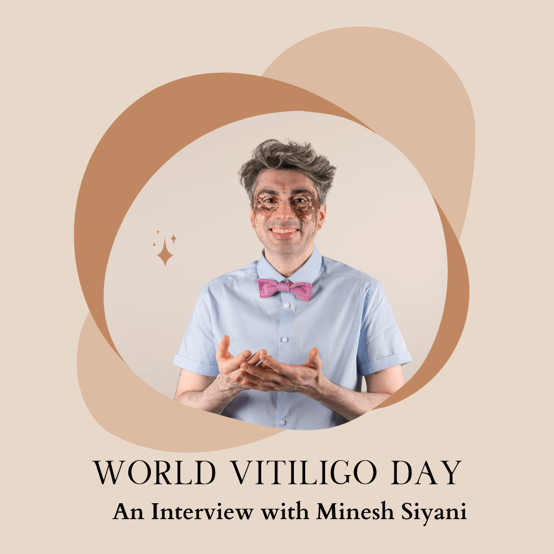 World Vitiligo Awareness Day: An Interview with Minesh Siyani - Wool & Water